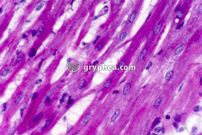 Fibres musculaires cardiaques CL x200 - gryphea.com